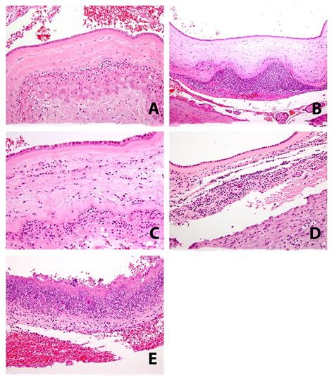 Placental Membranes Histology