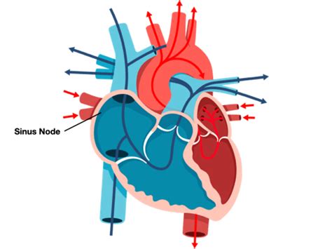 Atrial Fibrillation Animation Gif