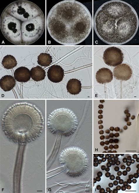 Aspergillus brasiliensis - Atlas of Clinical Fungi