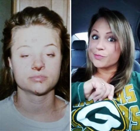 Inspiring photos show drug users before and after they got clean | Metro News