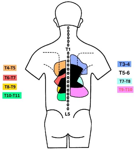 Physiotherapy for Thoracic Pain | Assessment & Treatment