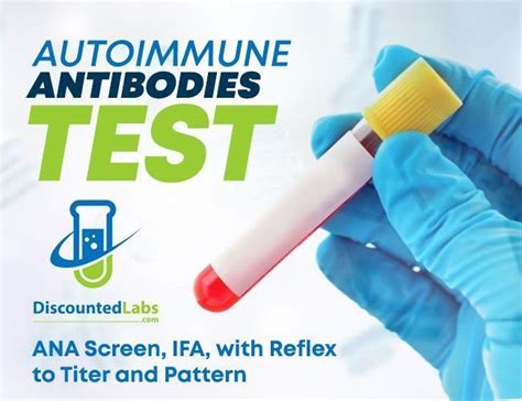 Autoimmune Antibodies: ANA Screen, IFA, with Reflex to Titer and Pattern