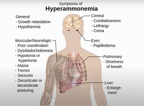 How To Lower High Ammonia Levels in The Blood - Page 3 of 8 - A2Z Healthy