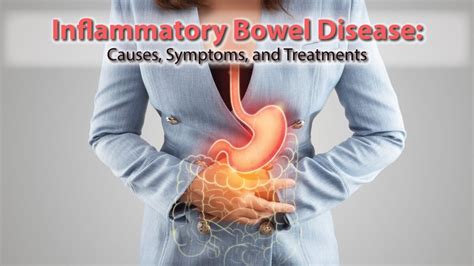 Inflammatory Bowel Disease: Causes, Symptoms, and Treatments