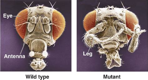 homeotic.html 18_18-AbnormalPatternForm-L.jpg