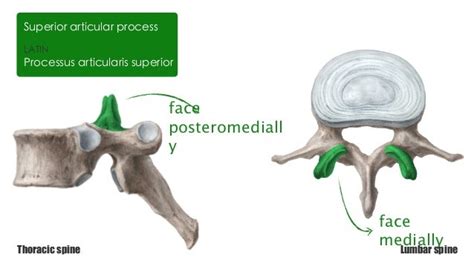 Pediculus Arcus Vertebrae