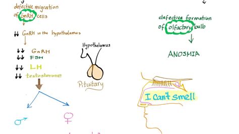 Klinefelter Syndrome Mnemonic