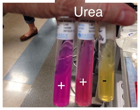 Urea agar tests for the ability of the organism to make urease. The ...