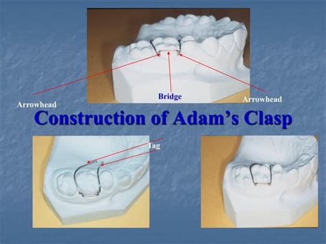 Adam's clasp | PPT | Free Download