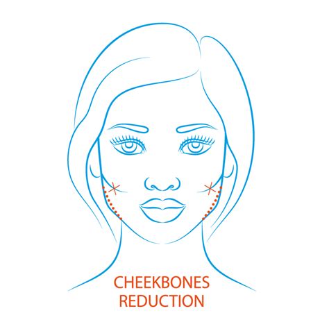 Plastic Surgery | Face | Cheekbone Reduction – H2 Clinic