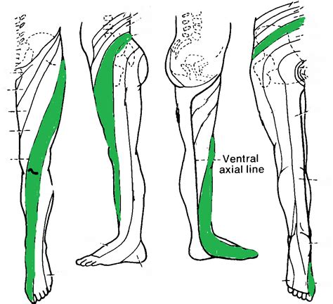 s1 dermatome map