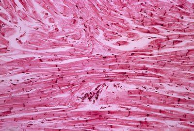 Cardiac muscle, light micrograph - Stock Image - C010/6042 - Science Photo Library