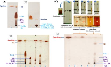 Separation and purification of squalene by TLC. (A) Lipid separation ...