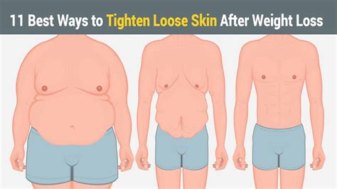 11 Best Ways to Tighten Loose Skin After Weight Loss | 5 Minute Read