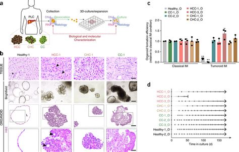 Patient-derived primary liver cancer organoid cultures expand long-term... | Download Scientific ...