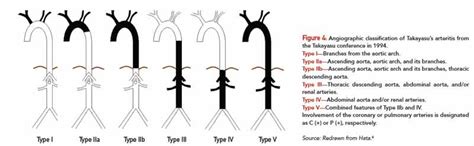 Fellow’s Forum Case Report: Takayasu’s Arteritis - Page 4 of 7 - The ...