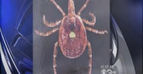 Health: Tick Bite May Cause Surprising Allergy - CBS Philadelphia