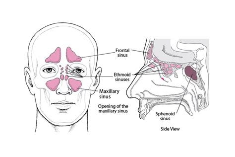 How to Relieve Sinus Pressure: Sinus Massage - Body Sanctum Day Spa