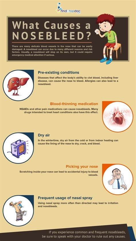 Nose Bleed: Causes, Diagnosis, and Treatment | FindATopDoc