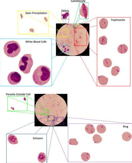 Stages of malaria in blood smear | Download Scientific Diagram