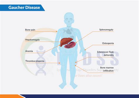 Gaucher Disease | LSDSS India