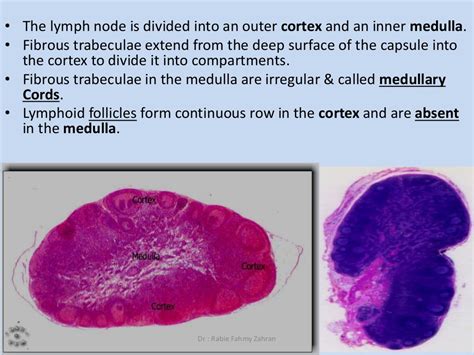 Cervical lymphadenopathy