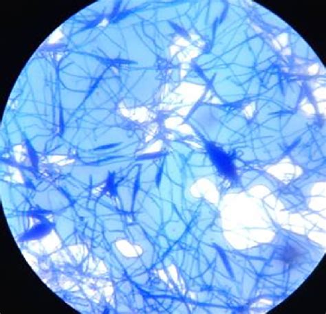 Microscopic appearance of Microsporum audouinii macroconidia. Some are... | Download Scientific ...