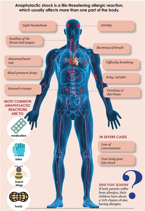 Researchers identified a new pathological mechanism responsible for anaphylactic shock - https ...