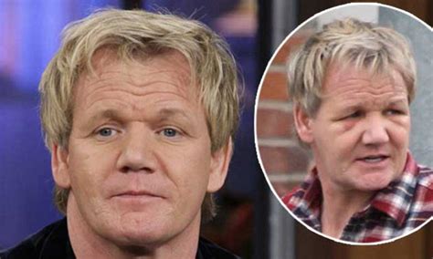 Gordon Ramsay gives bizarre explanation for face after hair transplant | Daily Mail Online