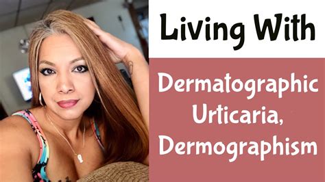 Dermatographic Urticaria/Dermographism - YouTube