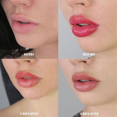 "Lip Blushing" Is the Cosmetic Procedure You Didn't Know You Wanted