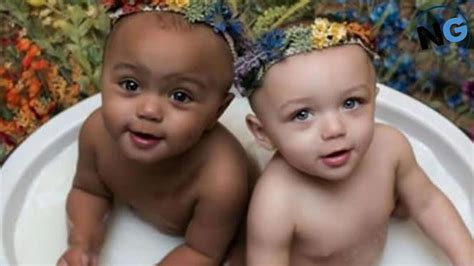 These Twins With Different Skin Colors Are ‘1 In A Million’ – Here They ...