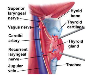 Laryngectomy India,Laryngectomy Larynx Surgery,Throat Surgery India