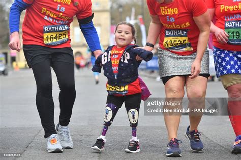 Five-year-old Harmonie-Rose Allen, who lost her limbs to meningitis ...