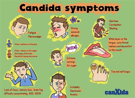 Signs & Symptoms of Candida | Candida symptoms, Candida overgrowth, Candida