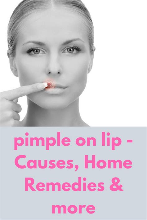 How To Get Rid Of Pimple.on Lip - HOWTOREMVO