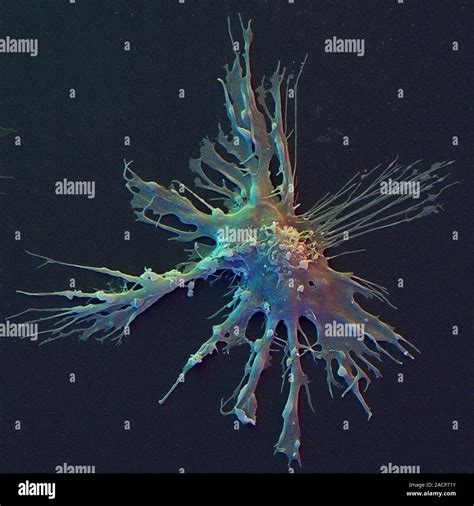 Dendritic cell, coloured scanning electron micrograph (SEM). Dendritic ...