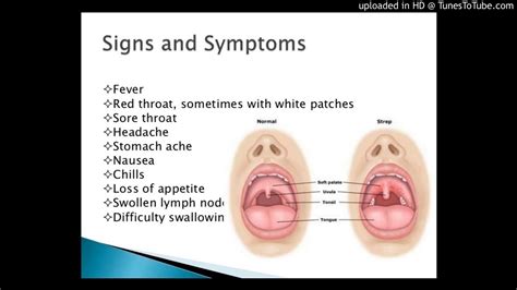 Group B Streptococcus Examples : Watertree Health Card | What Is Group B Strep? - For this ...