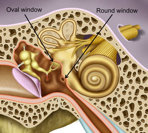 Perilymphatic fistula | Polyclinique Centre-Ville