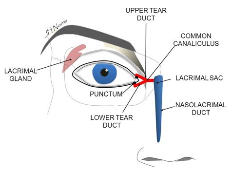 Tear duct syringing - Jonathan Norris