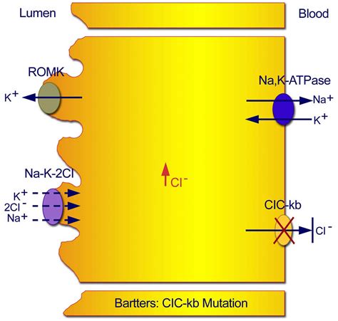 Bartter syndrome causes, symptoms, diagnosis, prognosis and treatment