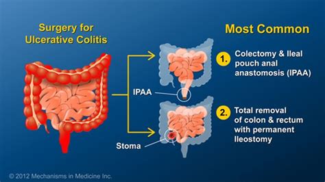 Pin on Medical CPT and Diagnosis Coding Tips