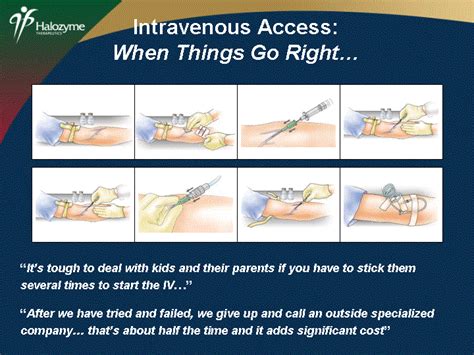 BruisingInfiltrationInfectionPhlebitisExtravasationExtravasation+ 10 daysIntravenous Access:When ...