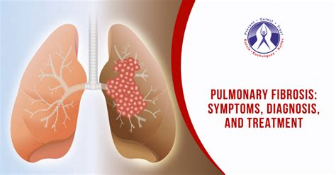 Pulmonary Fibrosis: Symptoms, Diagnosis, and Treatment