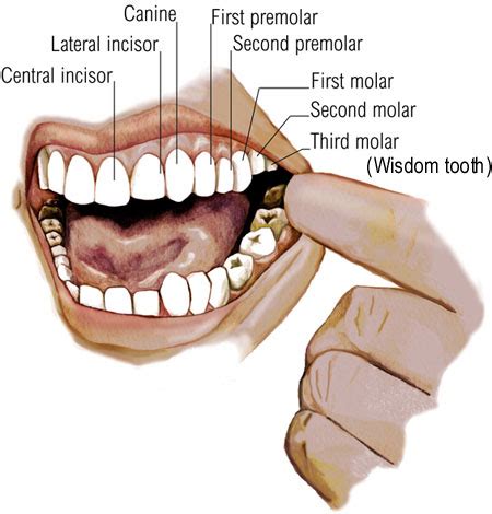 Los Angeles Wisdom Tooth Extraction Questions | Dr. Jamie Sands