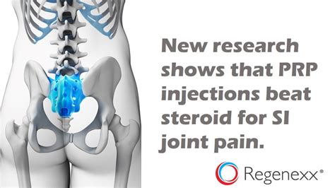 SI Joint injection side effects are a problem that can be avoided by ...