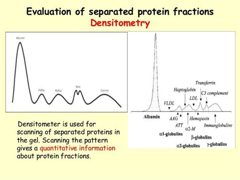 Interpreting serum protein electrophoresis