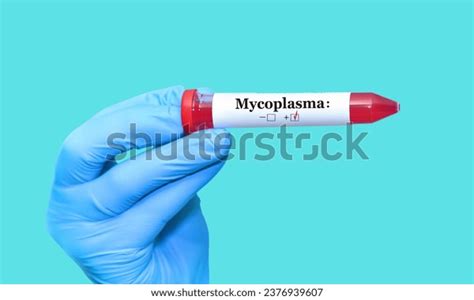 Microscopic View Mycoplasma Genitalium Mgen Tiny Stock Photo 2376939607 ...