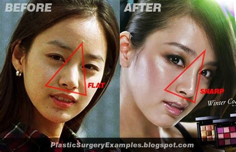 Plastic Surgery Examples: Kim Tae Hee plastic surgery before & after ...