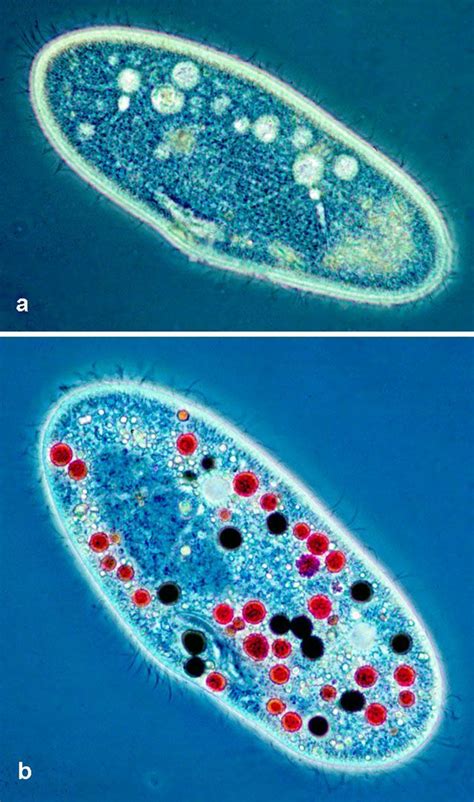 Paramecium cells....if you need a good picture of these little guys ...